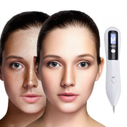 Clearskinpro -Laser -Plasma -Stift - Nicht -invasiv | Für Sommersprossen, Hautmarke, Fleck, Maulwurf und Tattoo zu Hause entfernen 3