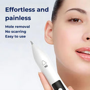 Clearskinpro -Laser -Plasma -Stift - Nicht -invasiv | Für Sommersprossen, Hautmarke, Fleck, Maulwurf und Tattoo zu Hause entfernen 7