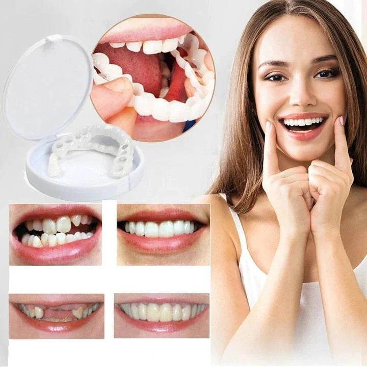 Sofortige Lächelverwandlung mit Snap on Smile Veneers 1